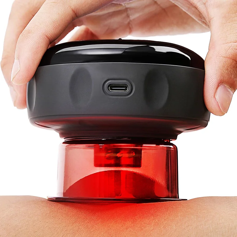 UOTT 20 Levels Smart Cupping Kit - Rank 6 in Best Massage Cups of 2025